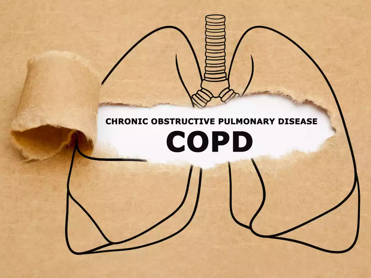 Can You Collect Social Security Disability if You Have COPD?